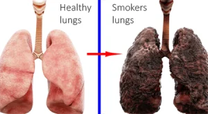 Image shows pink and healthy lungs (LHS). These are transformed into the ugly grey and scarred lungs of a ten year smoker. Smoking has been proven to cause fatal cancers.